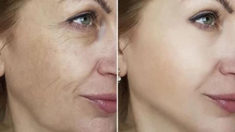 Mabox Award Winning Acne Clarifying Vitamin C Serum