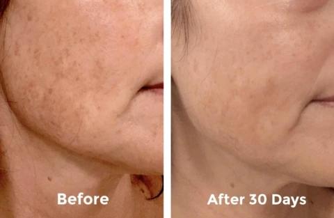 Mabox Vitamin C Serum;  Mabox 2.5% Retinol Moisturizer Face Cream [Buy Package Save 600KSH]