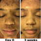 Mabox Vitamin C Serum;  Mabox 2.5% Retinol Moisturizer Face Cream [Buy Package Save 600KSH]