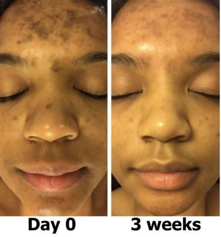 Mabox Vitamin C Serum;  Mabox 2.5% Retinol Moisturizer Face Cream [Buy Package Save 600KSH]