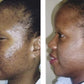 Mabox Vitamin C Serum;  Mabox 2.5% Retinol Moisturizer Face Cream [Buy Package Save 600KSH]