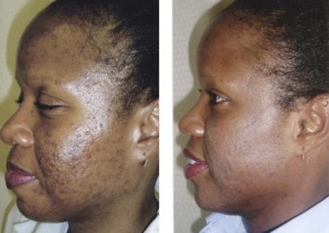 Mabox Vitamin C Serum;  Mabox 2.5% Retinol Moisturizer Face Cream [Buy Package Save 600KSH]